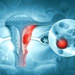 Best Practices for the diagnosis and staging of endometrial cancer