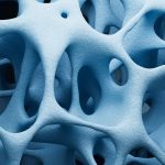 Osteoporosis: Positioning synthetic teriparatide in South African clinical practice